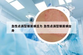 急性點滴型銀屑病乏力 急性點滴型銀屑病全身