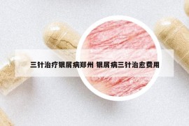 三針治療銀屑病鄭州 銀屑病三針治愈費(fèi)用