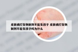 皮膚病打生物制劑不能生孩子 皮膚病打生物制劑不能生孩子嗎為什么