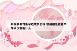 銀屑病會對備孕造成的影響 銀屑病患者備孕期間該準備什么