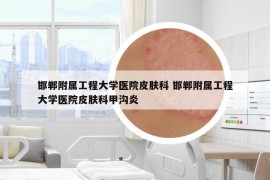 邯鄲附屬工程大學(xué)醫(yī)院皮膚科 邯鄲附屬工程大學(xué)醫(yī)院皮膚科甲溝炎