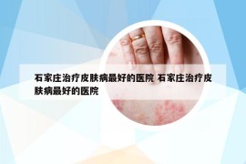 石家莊治療皮膚病最好的醫(yī)院 石家莊治療皮膚病最好的醫(yī)院