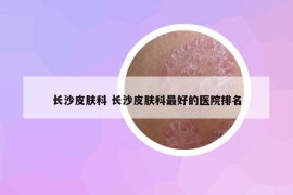 長(zhǎng)沙皮膚科 長(zhǎng)沙皮膚科最好的醫(yī)院排名