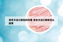 用完卡泊三醇后的效果 用完卡泊三醇癢怎么回事