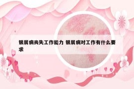 銀屑病喪失工作能力 銀屑病對工作有什么要求