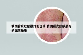 我國(guó)看皮膚病最好的醫(yī)生 我國(guó)看皮膚病最好的醫(yī)生是誰
