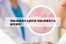 阿維a膠囊有什么副作用 阿維a膠囊有什么副作用嗎?