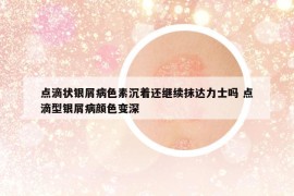 點(diǎn)滴狀銀屑病色素沉著還繼續(xù)抹達(dá)力士嗎 點(diǎn)滴型銀屑病顏色變深