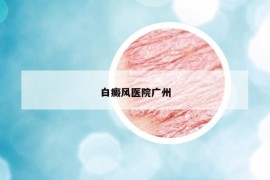 白癜風(fēng)醫(yī)院廣州