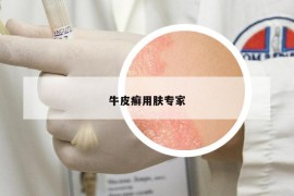 牛皮癬用膚專家