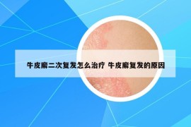 牛皮廨二次復(fù)發(fā)怎么治療 牛皮廨復(fù)發(fā)的原因