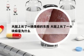 大腿上長了一塊像癬的東西 大腿上長了一小塊癬是為什么