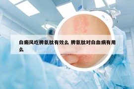 白癜風(fēng)吃脾氨肽有效么 脾氨肽對白血病有用么
