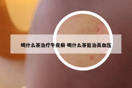 喝什么茶治療牛皮癬 喝什么茶能治高血壓