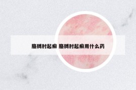 胳膊肘起癬 胳膊肘起癬用什么藥