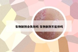 生物制劑會失效嗎 生物制劑不能停嗎