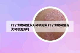 打了生物制劑多久可以洗澡 打了生物制劑當(dāng)天可以洗澡嗎