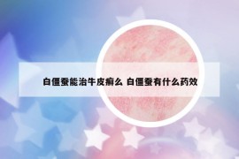 白僵蠶能治牛皮癬么 白僵蠶有什么藥效