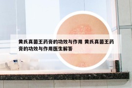 黃氏真菌王藥膏的功效與作用 黃氏真菌王藥膏的功效與作用醫(yī)生解答