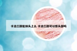 卡泊三醇能抹頭上么 卡泊三醇可以擦頭部嗎