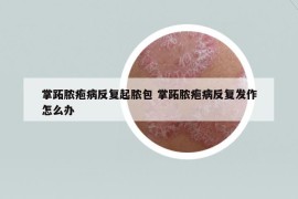 掌跖膿皰病反復起膿包 掌跖膿皰病反復發(fā)作怎么辦
