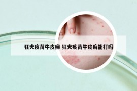 狂犬疫苗牛皮癬 狂犬疫苗牛皮癬能打嗎