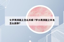 七歲男孩腿上怎么長(zhǎng)癬 7歲小男孩腿上長(zhǎng)毛怎么回事?