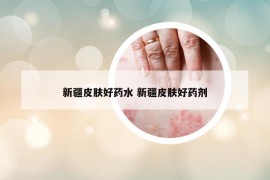 新疆皮膚好藥水 新疆皮膚好藥劑