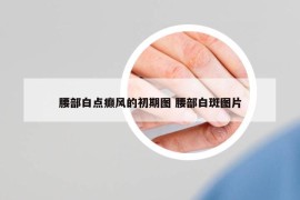 腰部白點(diǎn)癲風(fēng)的初期圖 腰部白斑圖片