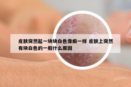 皮膚突然起一塊塊白色像癬一樣 皮膚上突然有塊白色的一般什么原因