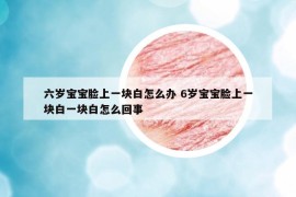 六歲寶寶臉上一塊白怎么辦 6歲寶寶臉上一塊白一塊白怎么回事