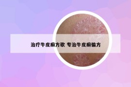 治療牛皮癬方歌 專治牛皮癬偏方