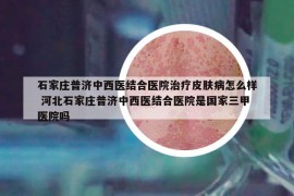 石家莊普濟(jì)中西醫(yī)結(jié)合醫(yī)院治療皮膚病怎么樣 河北石家莊普濟(jì)中西醫(yī)結(jié)合醫(yī)院是國家三甲醫(yī)院嗎