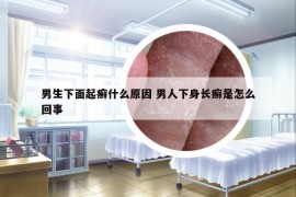 男生下面起癬什么原因 男人下身長癬是怎么回事