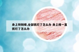 身上特別癢,全部抓爛了怎么辦 身上癢一直抓爛了怎么辦