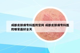 成都皮膚病?？漆t(yī)院官網(wǎng) 成都皮膚病?？漆t(yī)院哪家最好全天
