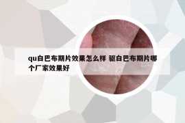 qu白巴布期片效果怎么樣 驅(qū)白巴布期片哪個廠家效果好