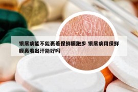 銀屑病能不能裹著保鮮膜跑步 銀屑病用保鮮膜裹著出汗能好嗎