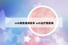uvb銀屑病清除率 uvb治療銀屑病