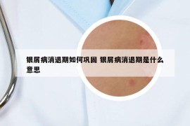 銀屑病消退期如何鞏固 銀屑病消退期是什么意思
