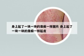 身上起了一塊一塊的像癬一樣圖片 身上起了一塊一塊的像癬一樣起皮