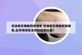 抗體類生物制劑有哪些 抗體類生物制劑有哪些,在何領(lǐng)域有怎樣的應(yīng)用價(jià)值?