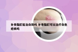 補(bǔ)骨脂酊能治白斑嗎 補(bǔ)骨脂酊可以治療白色疤痕嗎
