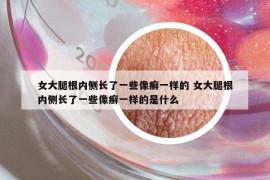女大腿根內(nèi)側(cè)長(zhǎng)了一些像癬一樣的 女大腿根內(nèi)側(cè)長(zhǎng)了一些像癬一樣的是什么