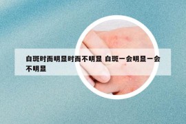 白斑時而明顯時而不明顯 白斑一會明顯一會不明顯