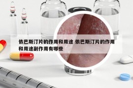 依巴斯汀片的作用和用途 依巴斯汀片的作用和用途副作用有哪些