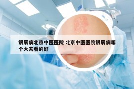 銀屑病北京中醫(yī)醫(yī)院 北京中醫(yī)醫(yī)院銀屑病哪個(gè)大夫看的好