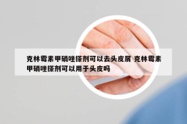 克林霉素甲硝唑搽劑可以去頭皮屑 克林霉素甲硝唑搽劑可以用于頭皮嗎