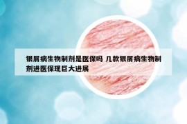 銀屑病生物制劑是醫(yī)保嗎 幾款銀屑病生物制劑進醫(yī)?，F(xiàn)巨大進展