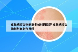 皮膚病打生物制劑多長時間能好 皮膚病打生物制劑有副作用嗎